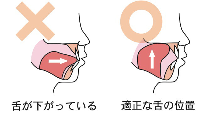 舌癖について