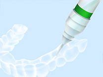 STEP3薬剤注入