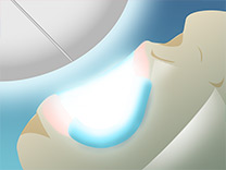 STEP4光照射